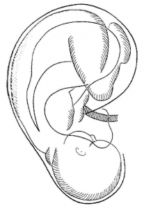 Ohr-Akupunktur - der auf den Kopf gestellte Körper spiegelt sich im Ohr wieder